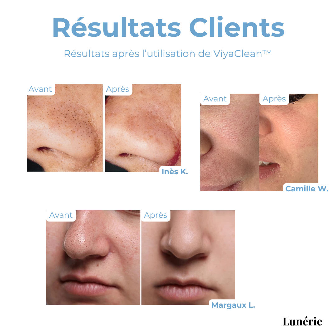 ViyaClean™ Reinigungsserum für die Poren