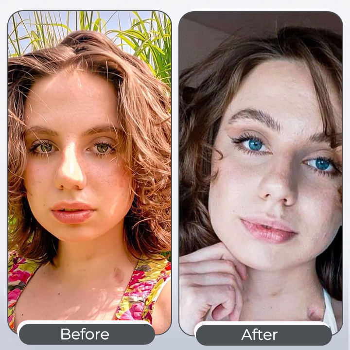 EyeKolor™ | Iris-Ink Farbwechsel Augentropfen