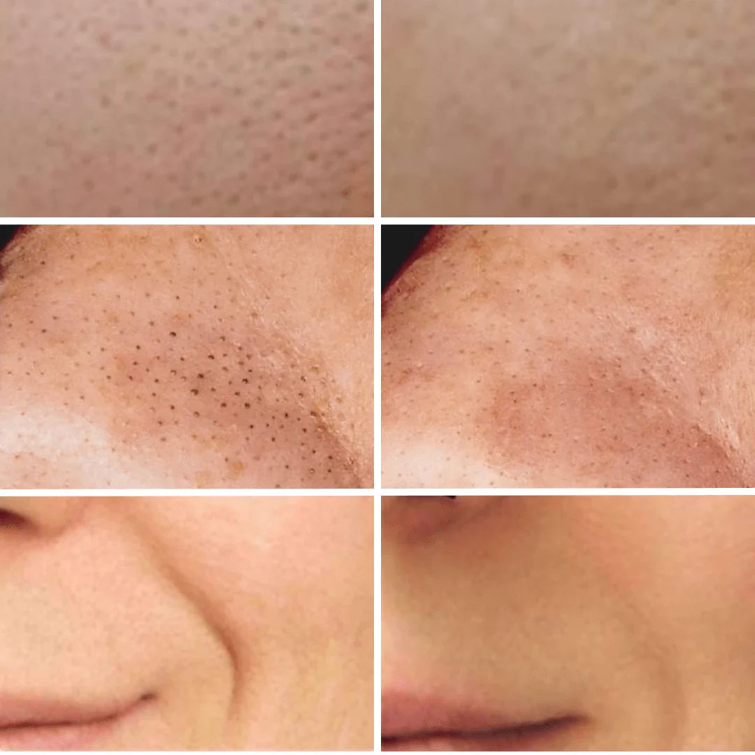 Ultraschall-Hautreiniger RawaiClean™