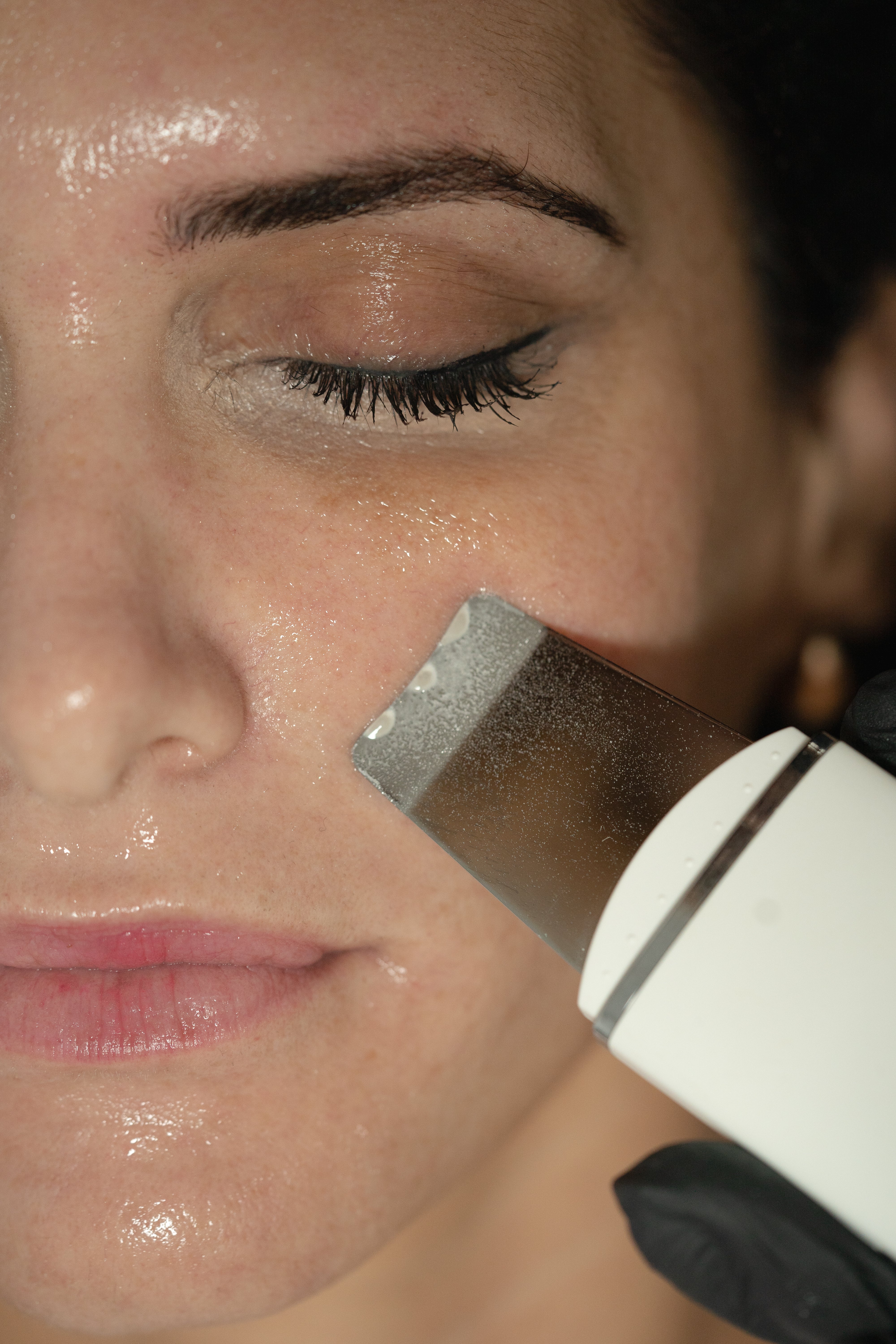 Ultraschall-Hautreiniger RawaiClean™